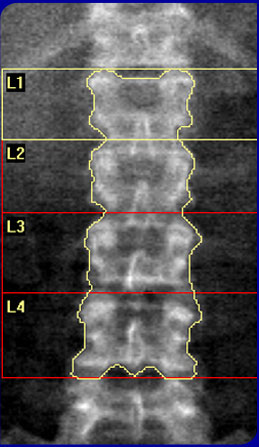 X-Ray