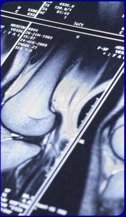 X-Ray